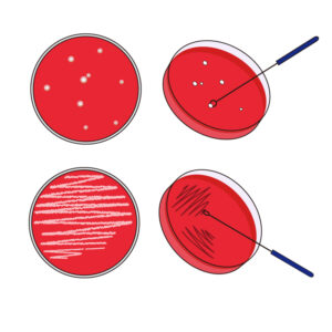 Culture：Salmonella/Shigella culture  細菌培養鑑定檢查(沙門氏菌/志賀氏菌培養)，糞便傷寒檢測，桿菌性痢疾